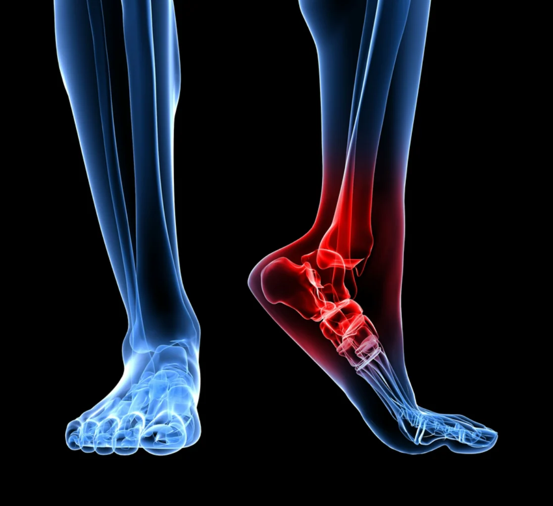 Sandales orthopédiques pour femmes | Confort - Image 5