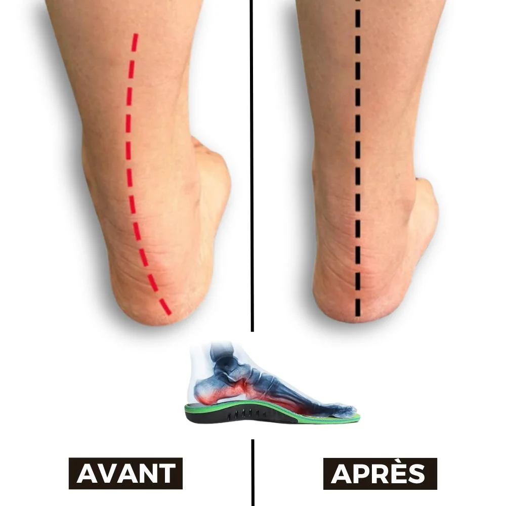 Semelles Orthopédiques Fasciite Plantaire Confort & Soutien - Image 2